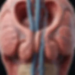 Anatomical diagram of cerebral arteriovenous fistula