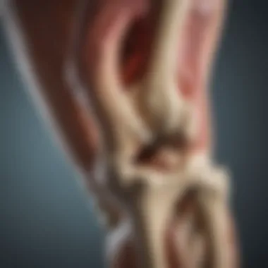 Knee Joint Anatomy Illustration of knee joint anatomy