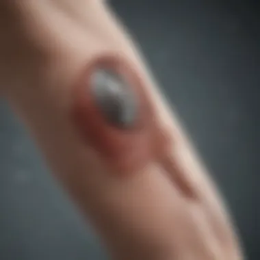 Misconceptions Surrounding the Implant Common misconceptions about the arm implant