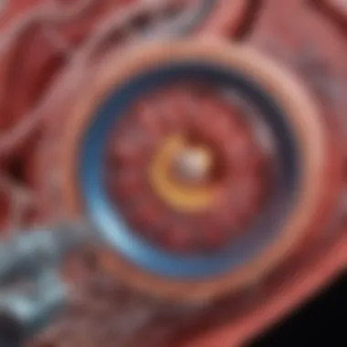 Mechanisms of Coronary Infarction Diagram illustrating the mechanisms leading to coronary infarction.