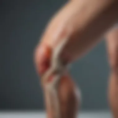 Chart showing impact of knee pain on quality of life indices