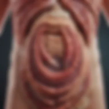 Illustration of the Colon and Colitis Affected Areas Detailed illustration of the colon showcasing areas affected by colitis