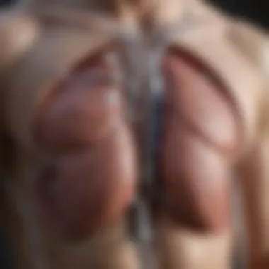 Understanding Dialysis Port Placement Illustration of a dialysis port placement in the chest