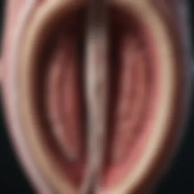 Diagram illustrating the anatomy of the urethra