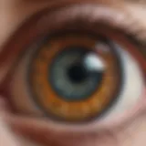 Illustration depicting the anatomy of the eye highlighting the lens and potential areas affected by cataract surgery