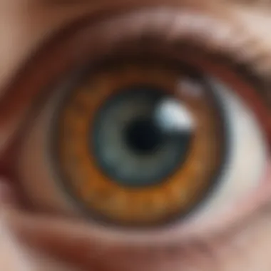 Illustration depicting the anatomy of the eye highlighting the lens and potential areas affected by cataract surgery
