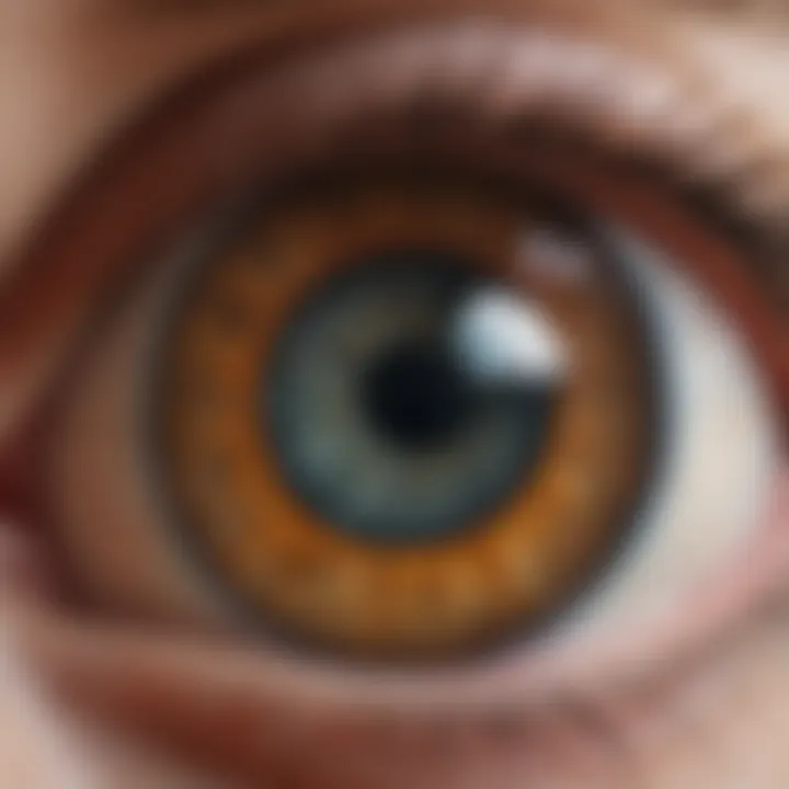 Illustration depicting the anatomy of the eye highlighting the lens and potential areas affected by cataract surgery