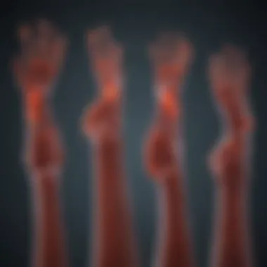 Visual representation of neuropathy types linked to myeloma