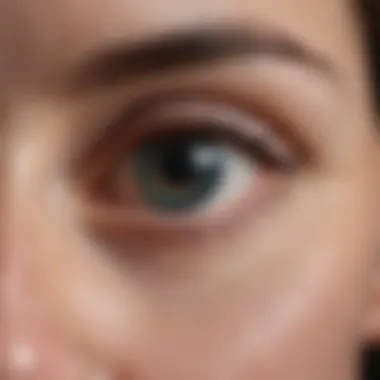 Graves' Disease and Ocular Pressure Connection Diagram illustrating the connection between Graves' disease and elevated ocular pressure.