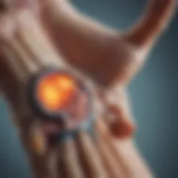 Illustration depicting the pathology of osteoarthritis in the wrist joint