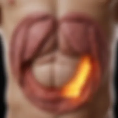 Stomach Cancer Staging Diagram illustrating the stages of stomach cancer