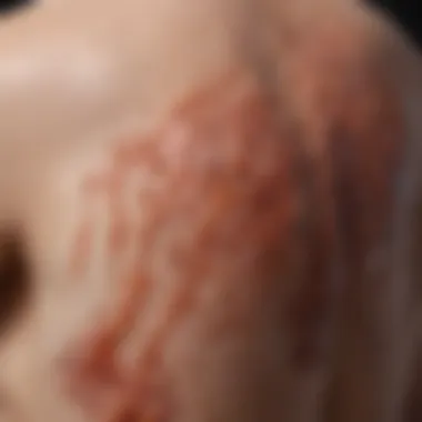 Detailed Examination of Psoriasis Lesions Microscopic view of psoriasis skin lesion