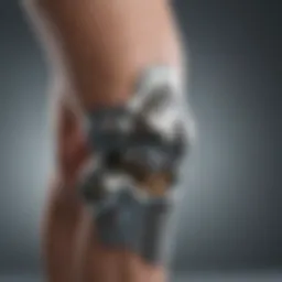 Detailed view of a steel knee prosthesis