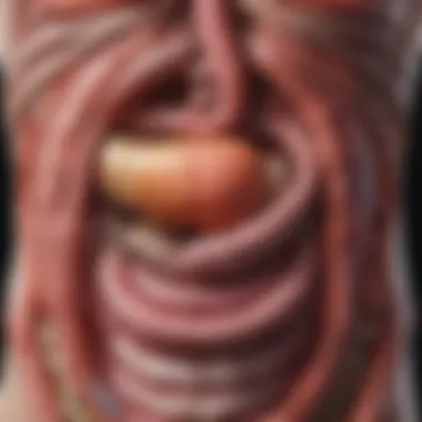 Illustration of the digestive system affected by ulcerative colitis