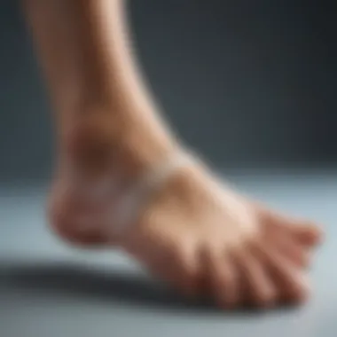 Conservative Treatment Options for Plantar Calcaneal Spur Graphic representation of conservative treatment options