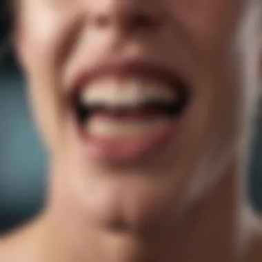 Types of Dental Abscesses Explained Diagram showcasing the types of dental abscesses