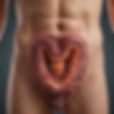Illustration of Colonic Inflammation in Colitis Diagram of the colon highlighting inflammation