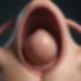Understanding Stage 2 Bladder Prolapse: An In-Depth Exploration Introduction